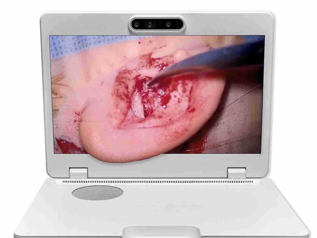 达擎之＂Heads-up 3D显微手术显示系统＂，，整合4K裸眼3D显示及眼球追踪系统，，，，具备快速追踪人眼移动位置功能，，，减轻医师长时间维持固定姿势的负担，，，，让医师能有更宽广清晰的3D立体视野及更舒适的姿势来执行手术。。。